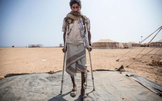 Shrapnel-injured Yemeni refugee Seif Zeid Abdulah stands on crutches at Markazi camp in Djibouti.