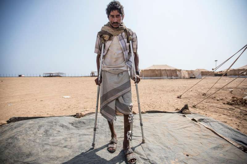 Shrapnel-injured Yemeni refugee Seif Zeid Abdulah stands on crutches at Markazi camp in Djibouti.