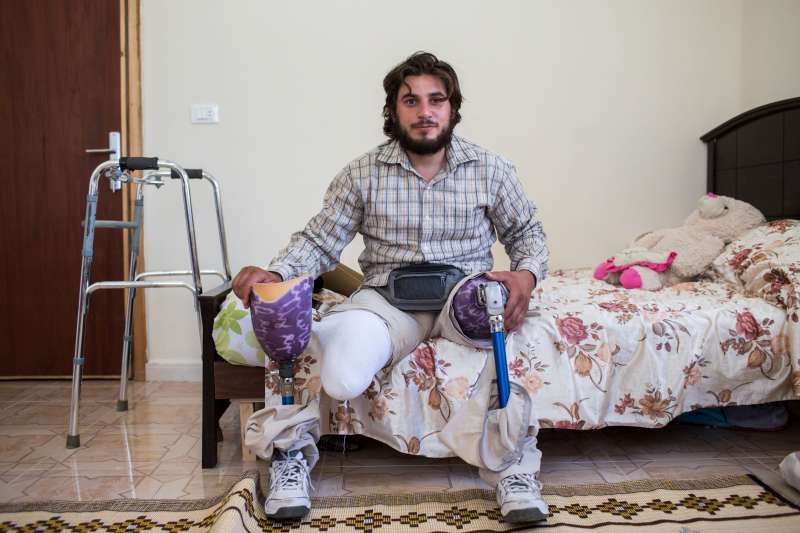 Ahmad fits his prosthetic limb.