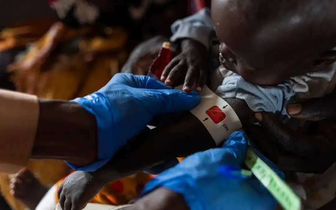 Le HCR et l’OMS mettent en garde contre la détérioration des conditions sanitaires au Soudan alors que 1 200 enfants sont morts des suites de malnutrition et d’une épidémie présumée de rougeole